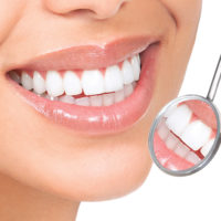 Chirurgie dentaire Tunisie