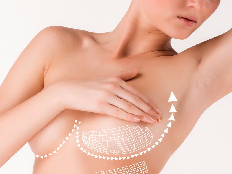 lifting seins tunisie