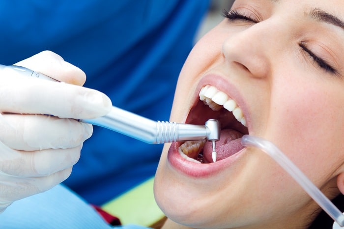 implant dentaire en Tunisie