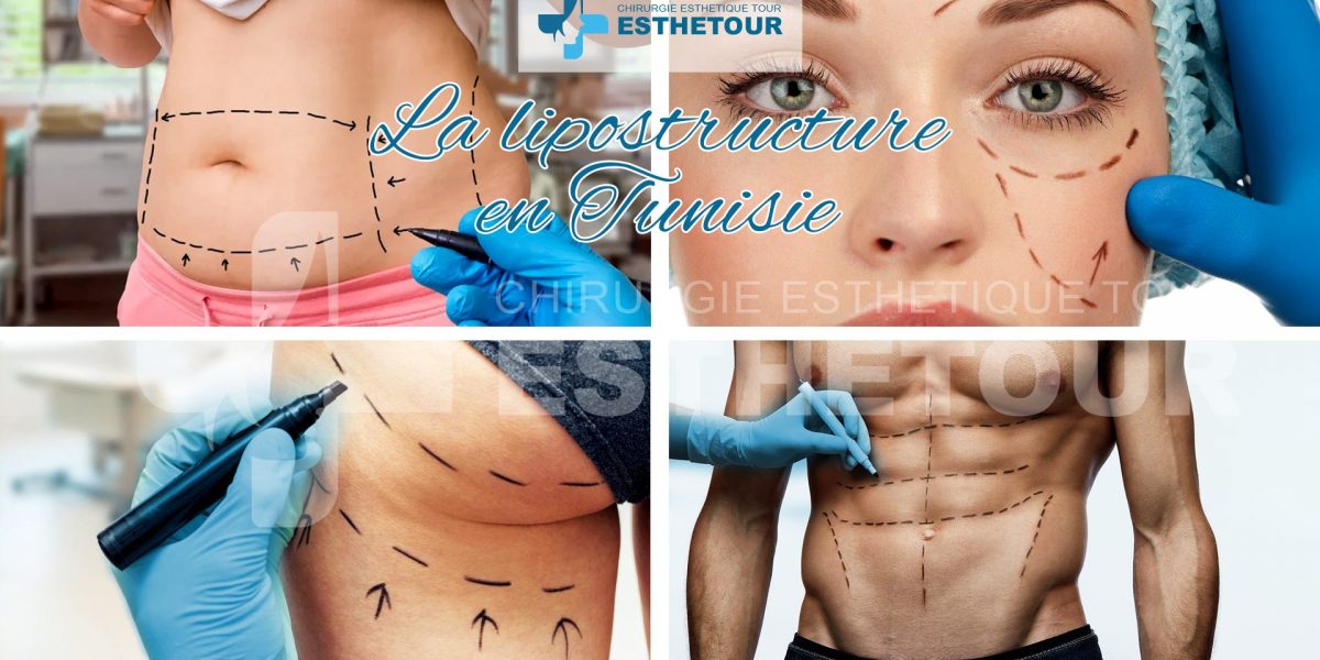 prix lipostructure en tunisie