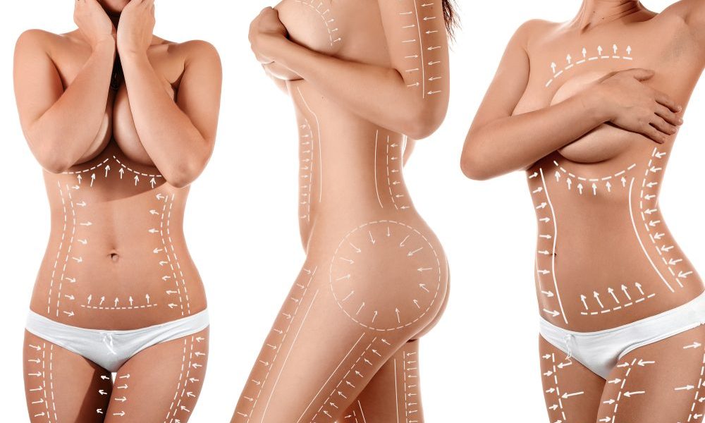 Liposuccion 360 Tunisie