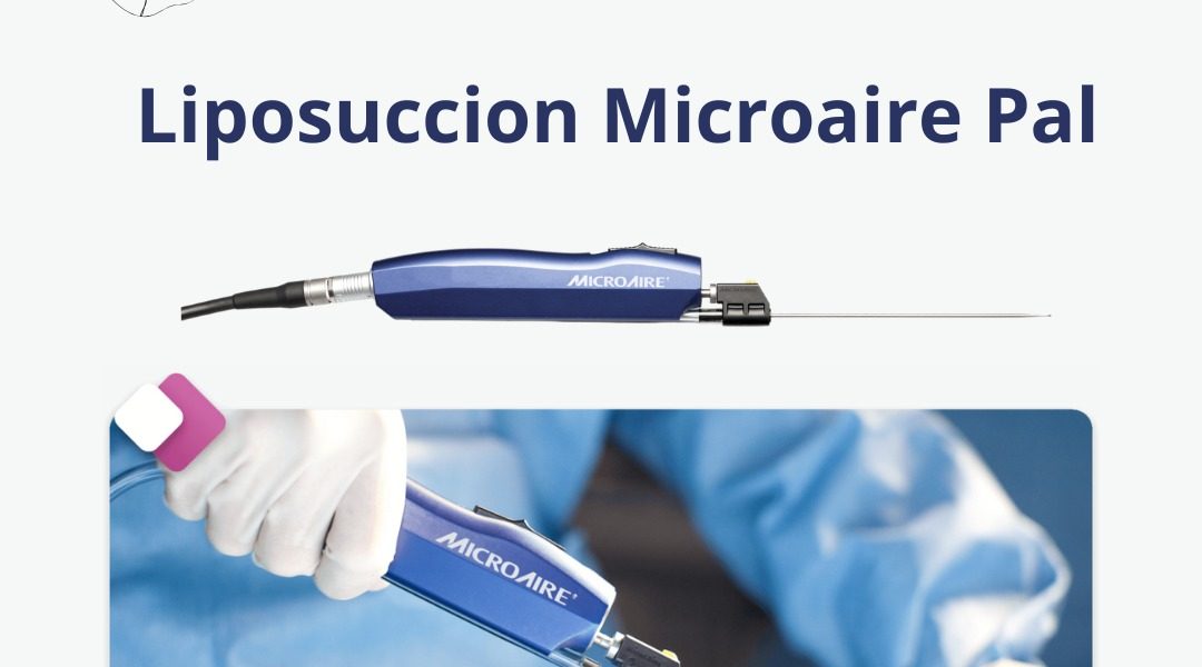 liposuccion PAL MicroAire Tunisie