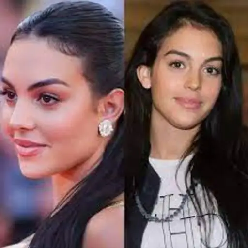 Georgina Rodriguez chirurgie esthétique