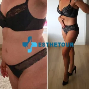 ventre plat femme